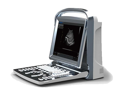 Chison  ECO1 Portable B&W Ultrasound