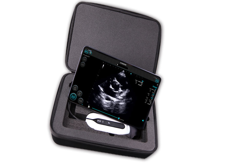 Handheld Digital Color Doppler Ultrasound System SonoEye P3 #