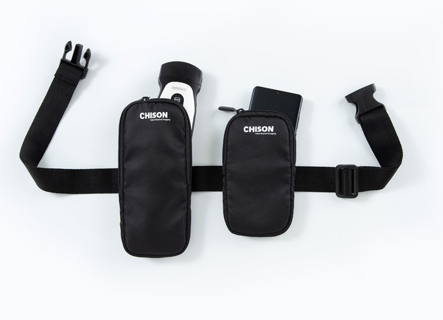 Handheld Digital Color Doppler Ultrasound System SonoEye P5 #