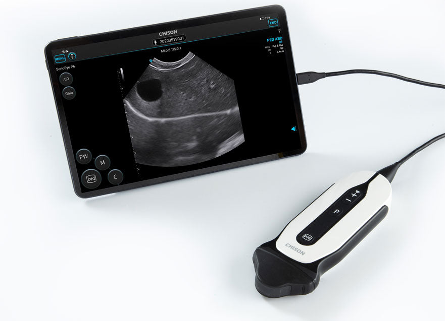 Handheld Digital Color Doppler Ultrasound System SonoEye P6 #