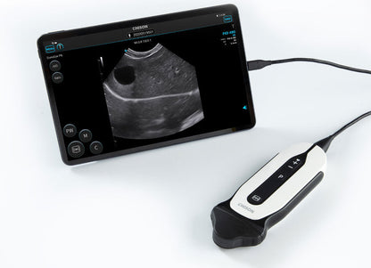 Handheld Digital Color Doppler Ultrasound System SonoEye P6 #