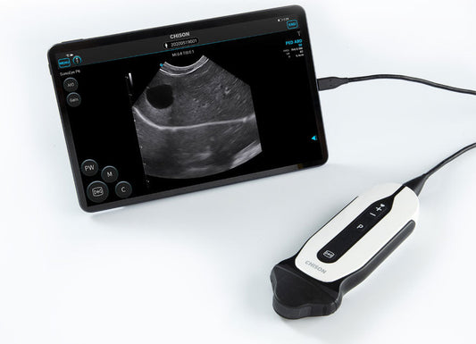 Handheld Digital Color Doppler Ultrasound System SonoEye P6 #