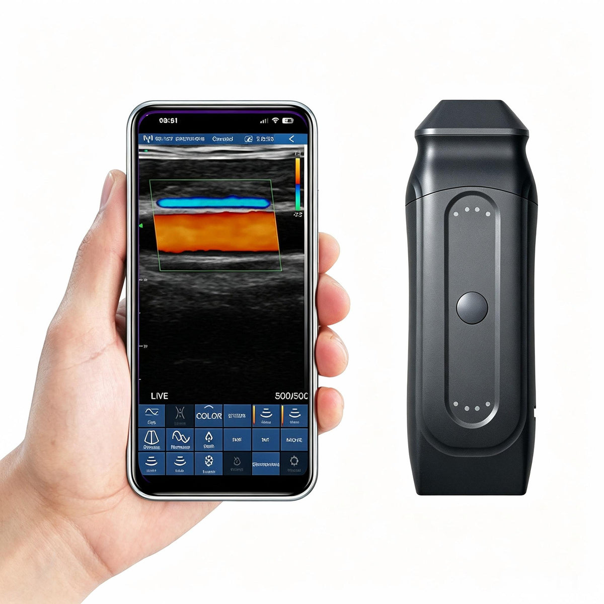 Global Healthcare Medical 2-in-1 palm doppler ultrasound scanner with dual-frequency linear array for point-of-care imaging