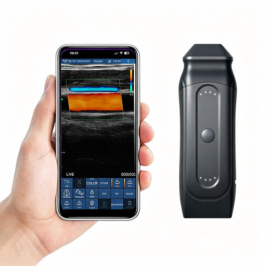 Global Healthcare Medical 2-in-1 palm doppler ultrasound scanner with dual-frequency linear array for point-of-care imaging