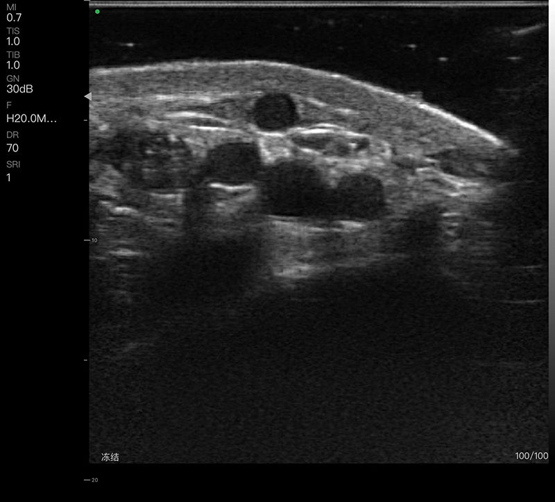 Global Healthcare Medical 2-in-1 palm doppler ultrasound scanner with dual-frequency linear array for point-of-care imaging