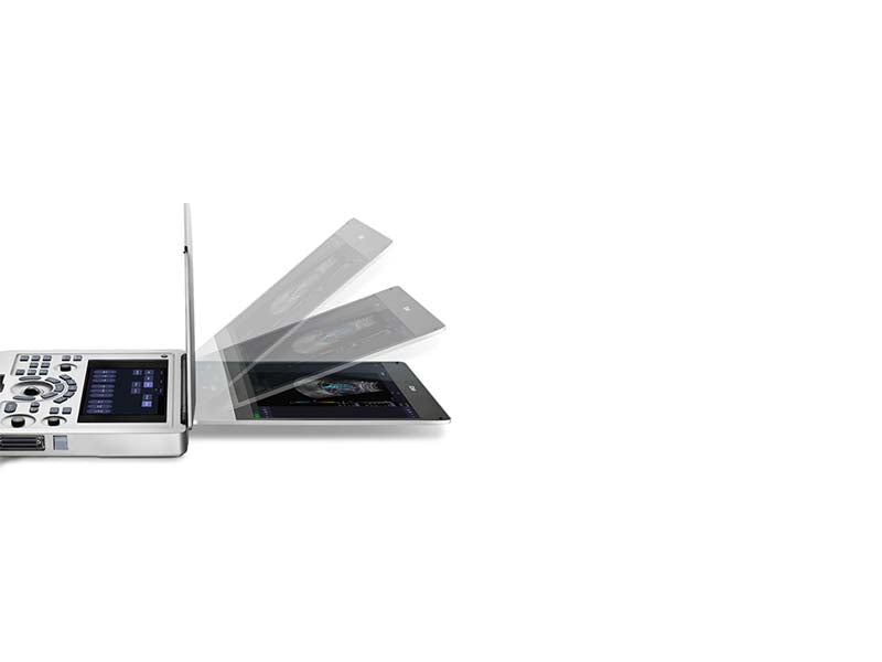 Edan Acclarix AX2 Portable Color Ultrasound
