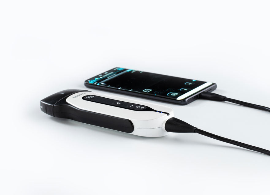 Handheld Digital Color Doppler Ultrasound System SonoEye P2 #