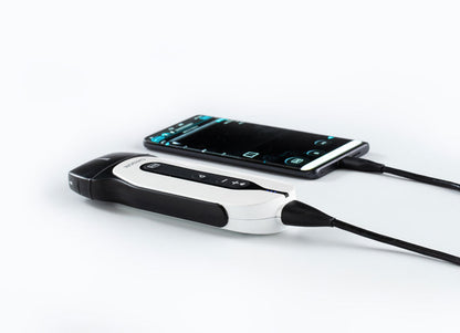 Handheld Digital Color Doppler Ultrasound System SonoEye P2 #