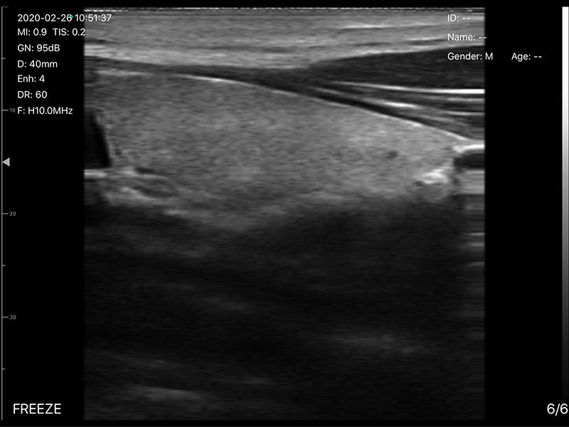 Global Healthcare Medical 2-in-1 palm doppler ultrasound scanner with convex and linear probes for point-of-care imaging