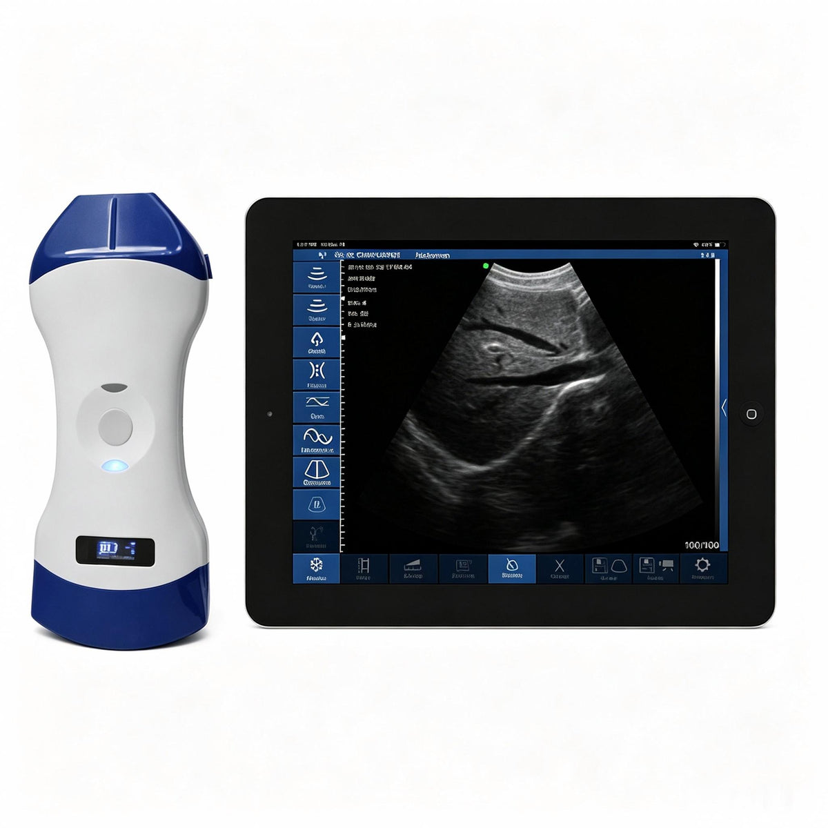 Global Healthcare Medical 2-in-1 palm doppler ultrasound scanner with convex and linear probes for point-of-care imaging