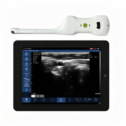 Global Healthcare Medical palm-sized biplane rectal ultrasound scanner with T-type probe for transrectal and urological imaging