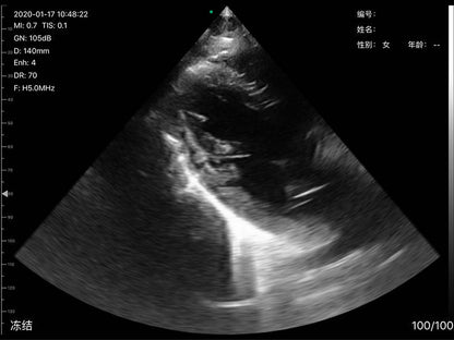 Global Healthcare Medical 2-in-1 palm doppler ultrasound scanner with phased array and linear probes for point-of-care imaging
