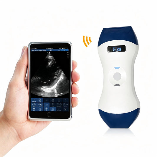 Global Healthcare Medical 2-in-1 palm doppler ultrasound scanner with phased array and linear probes for point-of-care imaging