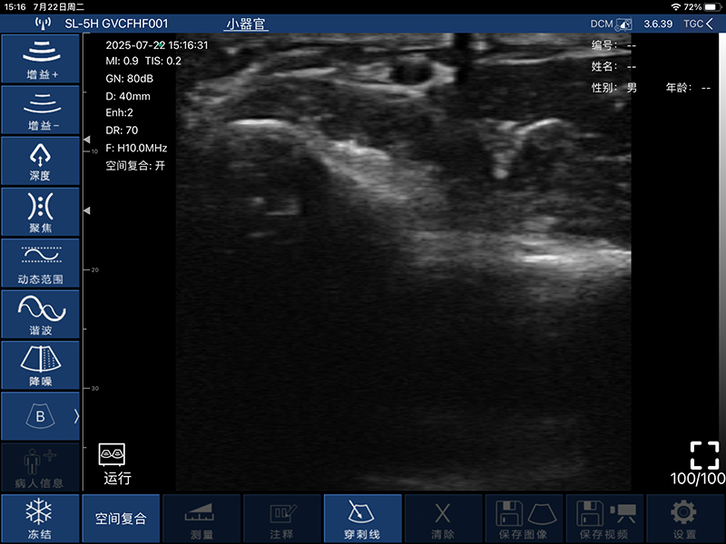 Global Healthcare Medical finger-sleeve probe handheld ultrasound scanner with 192-element linear array for hands-free imaging
