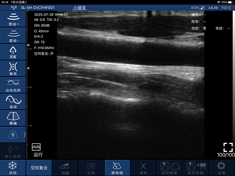 Global Healthcare Medical finger-sleeve probe handheld ultrasound scanner with 192-element linear array for hands-free imaging