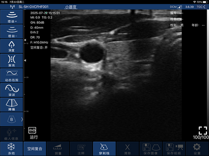 Global Healthcare Medical finger-sleeve probe handheld ultrasound scanner with 192-element linear array for hands-free imaging
