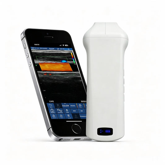 Global Healthcare Medical palm-sized wireless linear ultrasound scanner with 192-element probe for high-resolution superficial imaging