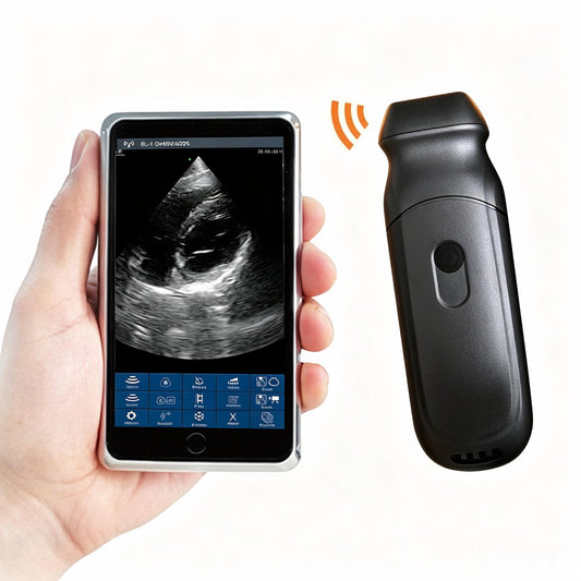 Global Healthcare Medical palm-sized wireless phased array ultrasound scanner with 192-element probe for cardiac and point-of-care imaging