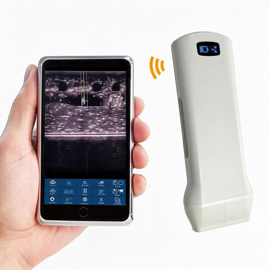 Global Healthcare Medical palm-sized wireless linear color Doppler ultrasound scanner with magnetic navigation for precise needle visualization