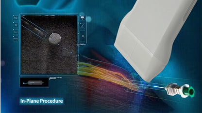 Global Healthcare Medical palm-sized wireless linear color Doppler ultrasound scanner with magnetic navigation for precise needle visualization