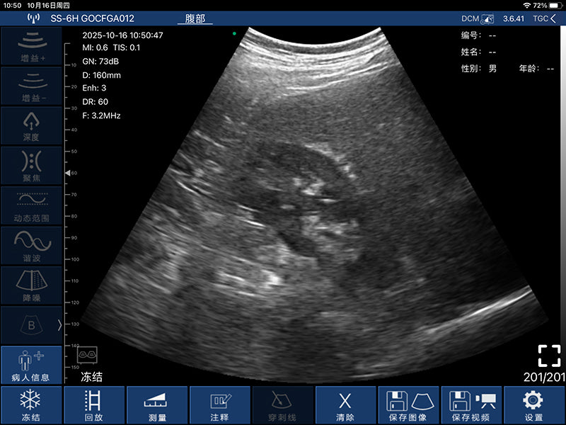 Global Healthcare Medical palm-sized wireless convex ultrasound scanner with 192-element probe for abdominal and point-of-care imaging