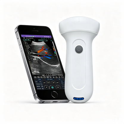 Global Healthcare Medical palm-sized wireless convex ultrasound scanner with 192-element probe for abdominal and point-of-care imaging