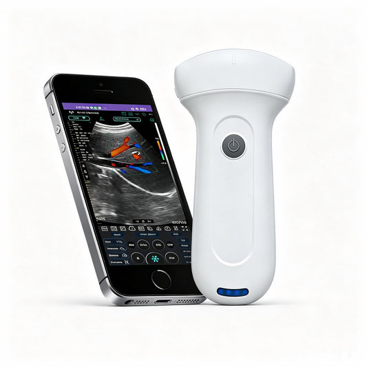 Global Healthcare Medical palm-sized wireless convex ultrasound scanner with 192-element probe for abdominal and point-of-care imaging