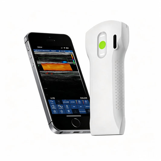 Global Healthcare Medical 3-in-1 palm doppler ultrasound scanner with convex, linear, and phased array probes for point-of-care imaging