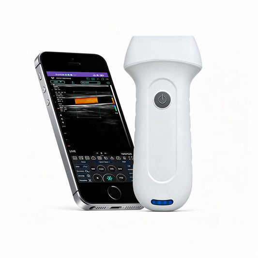 Global Healthcare Medical palm-sized wireless linear ultrasound scanner with 192-element probe for high-resolution superficial imaging