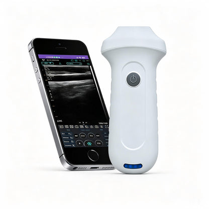 Global Healthcare Medical palm-sized wireless linear ultrasound scanner with 192-element probe for high-resolution superficial imaging
