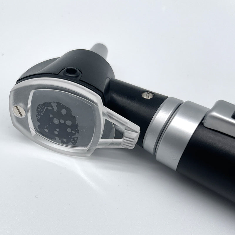 Portable Direct Illumination Otoscope for Ear Diagnostic #