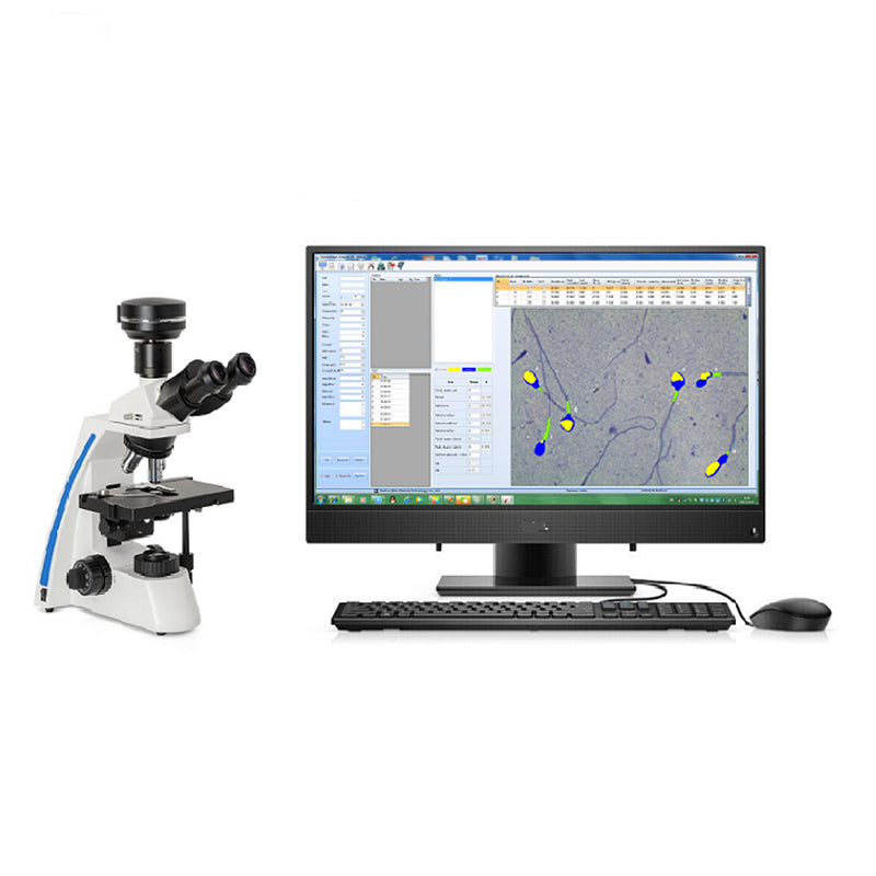 Semen Analyser Portable Laptop Semen Analysis Sperm Analyzer #