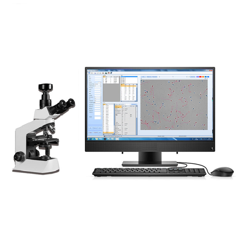 Semen Analysis Machine Microscope Sperm Quality Analyzer #