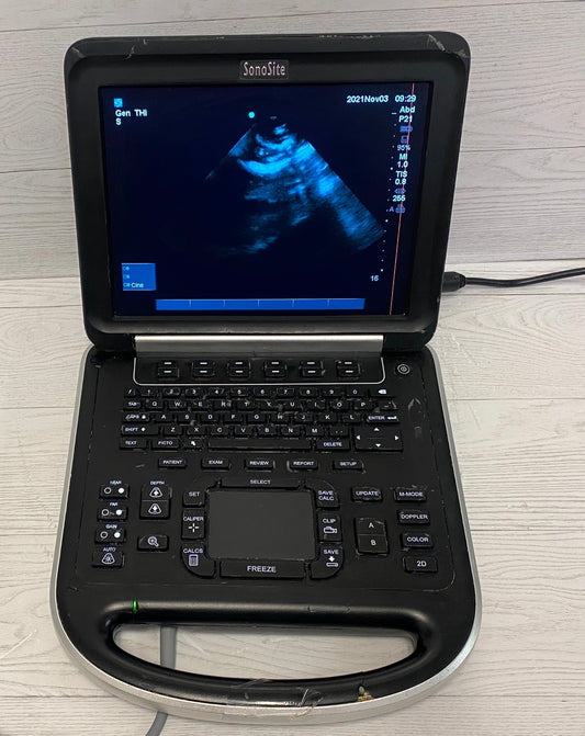 Sonosite Edge Portable Ultrasound 2013 #