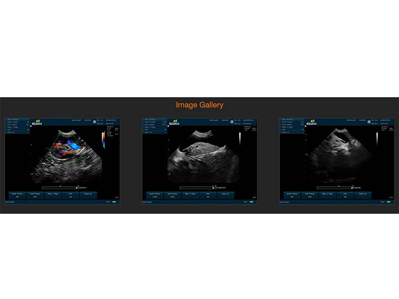9. U60 VET Veterinary Portable Ultrasound (1)