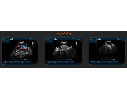 9. U60 VET Veterinary Portable Ultrasound (1)