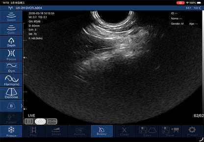 Global Healthcare Medical palm-sized biplane rectal ultrasound scanner with T-type probe for transrectal and urological imaging
