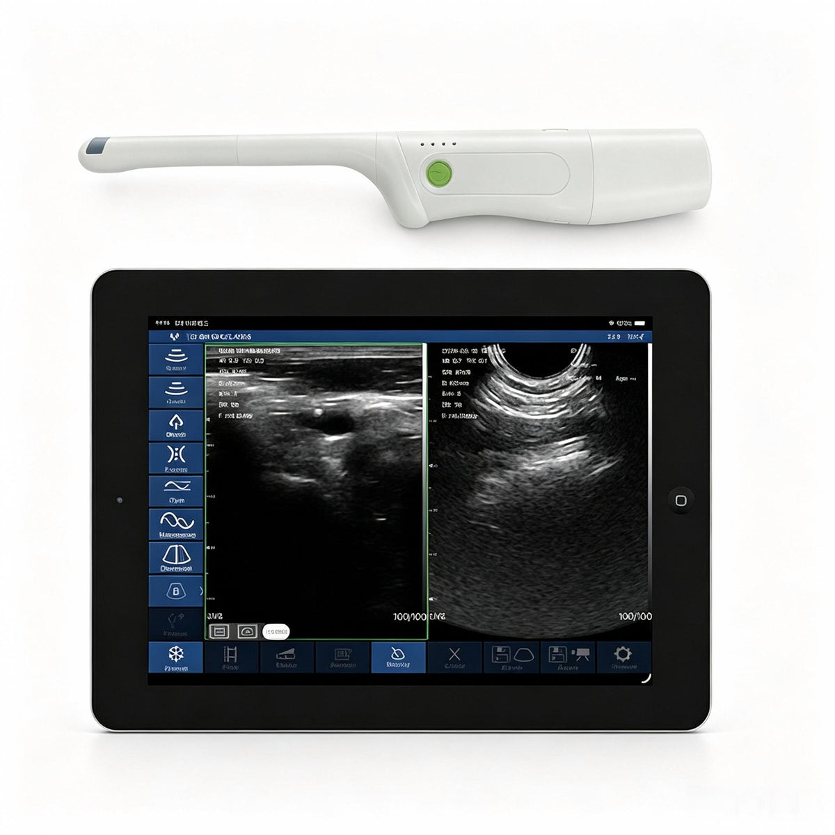 Global Healthcare Medical palm-sized biplane rectal ultrasound scanner with T-type probe for transrectal and urological imaging