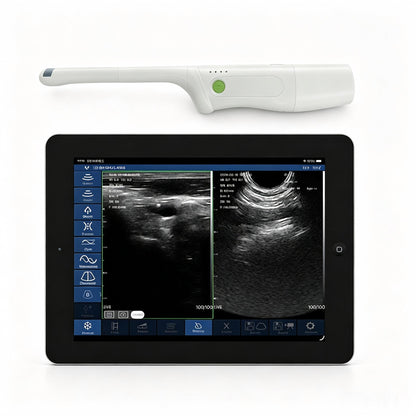 Global Healthcare Medical palm-sized biplane rectal ultrasound scanner with T-type probe for transrectal and urological imaging