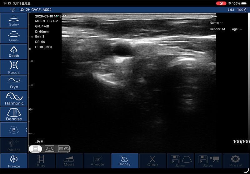 Global Healthcare Medical palm-sized biplane rectal ultrasound scanner with T-type probe for transrectal and urological imaging