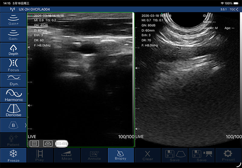 Global Healthcare Medical palm-sized biplane rectal ultrasound scanner with T-type probe for transrectal and urological imaging