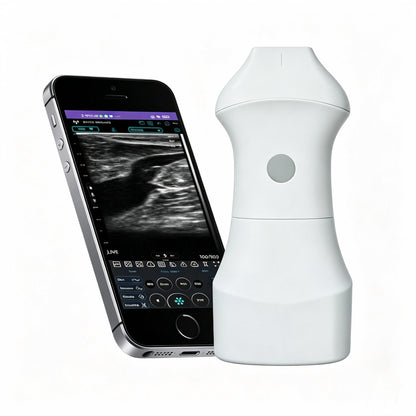 Global Healthcare Medical palm-sized wireless linear ultrasound scanner with replaceable battery for high-resolution superficial imaging