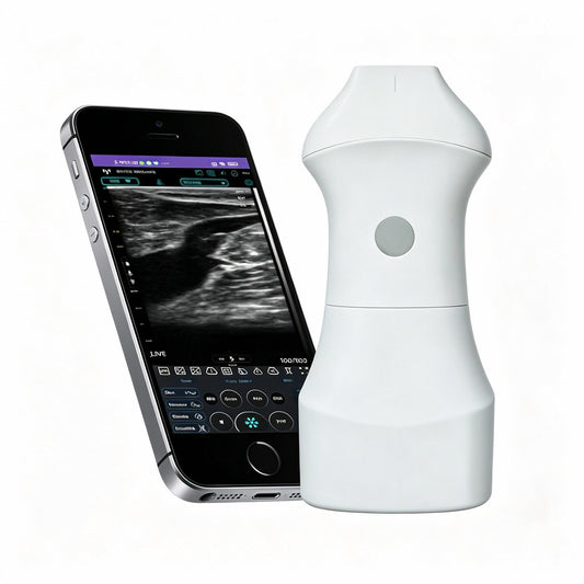 Global Healthcare Medical palm-sized wireless linear ultrasound scanner with replaceable battery for high-resolution superficial imaging