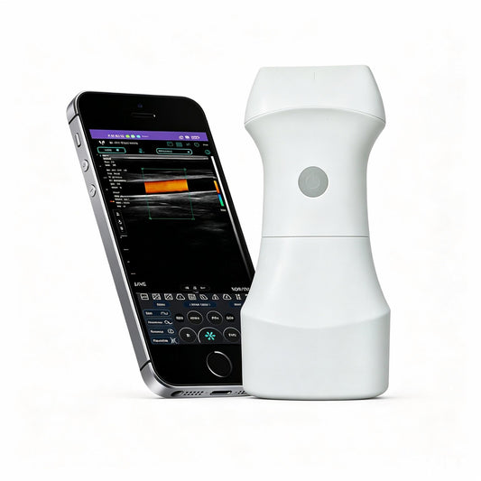 Global Healthcare Medical palm-sized wireless linear ultrasound scanner with replaceable battery for point-of-care imaging