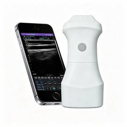 Global Healthcare Medical palm-sized wireless linear ultrasound scanner with replaceable battery for point-of-care imaging