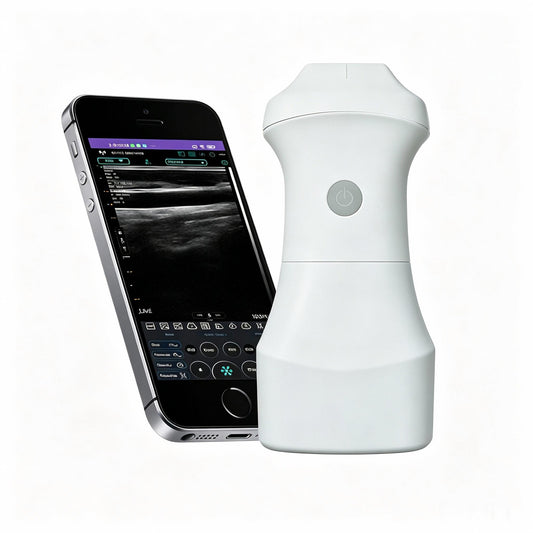 Global Healthcare Medical palm-sized wireless linear ultrasound scanner with replaceable battery for point-of-care imaging