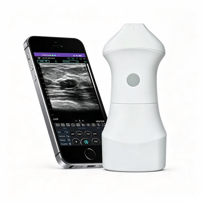 Global Healthcare Medical palm-sized wireless linear ultrasound scanner with replaceable battery for high-resolution superficial imaging