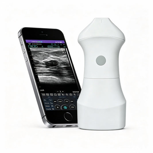 Global Healthcare Medical palm-sized wireless linear ultrasound scanner with replaceable battery for high-resolution superficial imaging