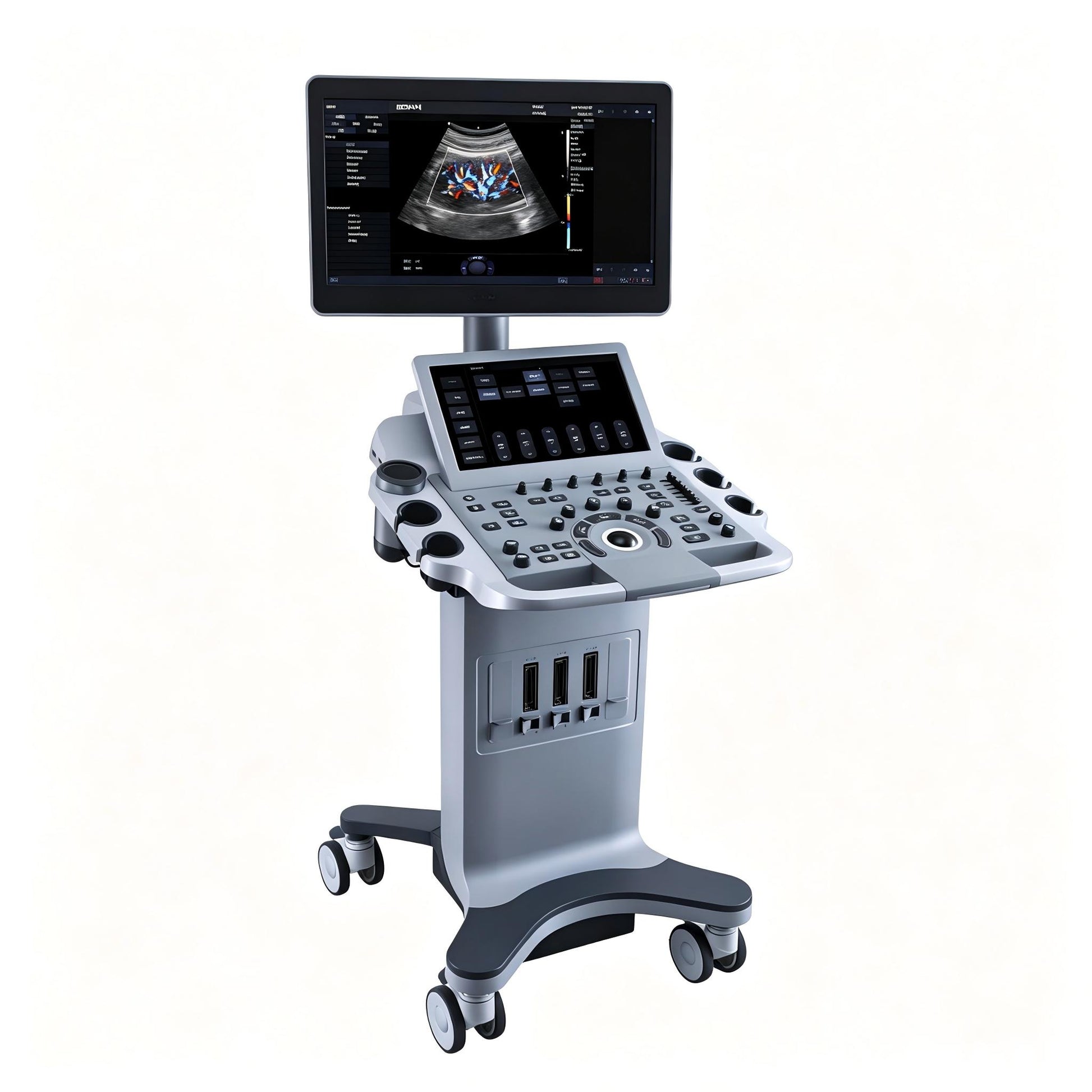 EDAN Acclarix LX25 stationary diagnostic ultrasound system with 21.5-inch display and 14-inch touchscreen