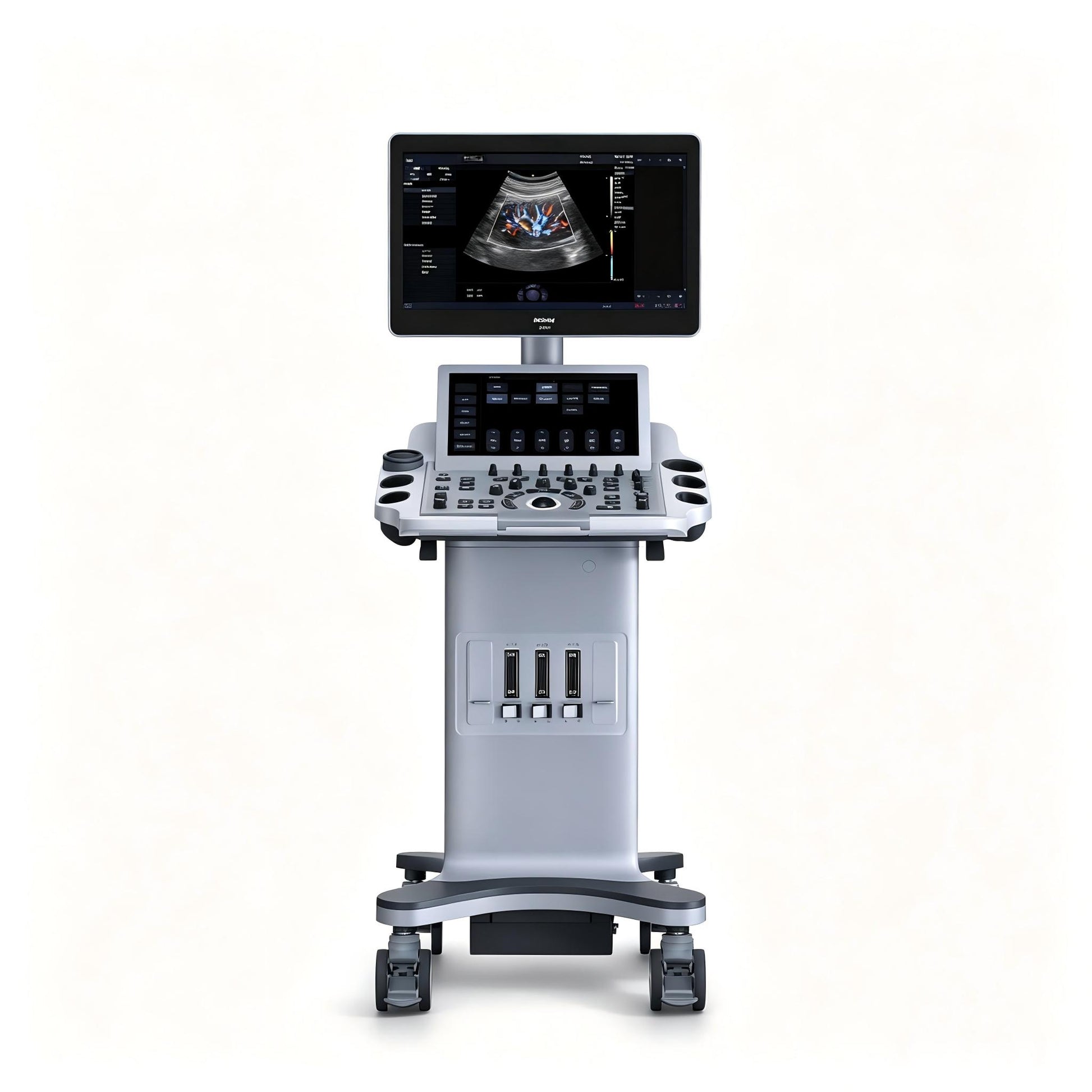 EDAN Acclarix LX25 stationary diagnostic ultrasound system with 21.5-inch display and 14-inch touchscreen
